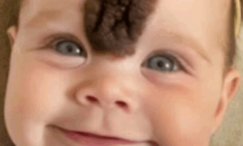 ¡Padres Remueven la Rara Marca de Nacimiento de su Bebé para Protegerla de la Crueldad! ¡Mira Cómo Luce Hoy!