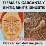 Remedios Naturales para Eliminar el Moco y la Flema en la Garganta