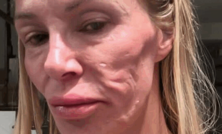 ¿Puedes Adivinar Quién Es Ella?: ¡Problemas de Salud Provocaron Cambios Significativos en su Apariencia!