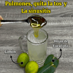 ¿Mocos en los pulmones? ¿Tos seca? ¿Sinusitis?