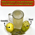 Si tienes pies hinchados, mala circulación, diabetes o grasa en el hígado… Si tienes pies hinchados, mala circulación, diabetes o grasa en el hígado…