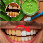 El Sorprendente Secreto de la Abuela para una Sonrisa de Hollywood: ¡Las Hojas de Guayaba Reveladas!