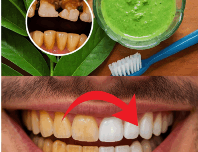 El Sorprendente Secreto de la Abuela para una Sonrisa de Hollywood: ¡Las Hojas de Guayaba Reveladas! El Sorprendente Secreto de la Abuela para una Sonrisa de Hollywood: ¡Las Hojas de Guayaba Reveladas!