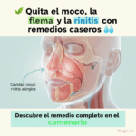 🌿 Moco y Flema: Remedios Caseros Efectivos para Aliviar la Congestión 🌿 Moco y Flema: Remedios Caseros Efectivos para Aliviar la Congestión