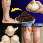 El Poder del Ajo: 9 Formas de Aliviar el Dolor y Revitalizar tu Cuerpo Naturalmente El Poder del Ajo: 9 Formas de Aliviar el Dolor y Revitalizar tu Cuerpo Naturalmente