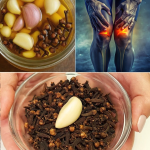 Ajo y Clavos de Olor: El Remedio Casero que Está Transformando las Várices y la Salud Circulatoria