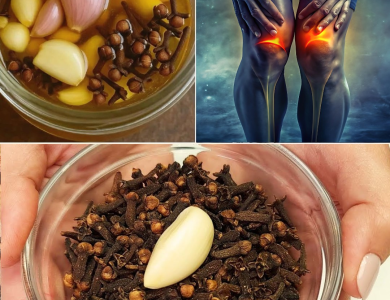 Ajo y Clavos de Olor: El Remedio Casero que Está Transformando las Várices y la Salud Circulatoria