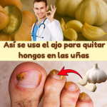Cómo eliminar hongos de la piel, uñas, manos, pies y cuero cabelludo con ajo: el remedio natural más potente Cómo eliminar hongos de la piel, uñas, manos, pies y cuero cabelludo con ajo: el remedio natural más potente