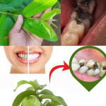 Descubre el Secreto de la Naturaleza: 3 Poderosos Remedios con Hojas de Guayaba para Combatir la Caries Dental
