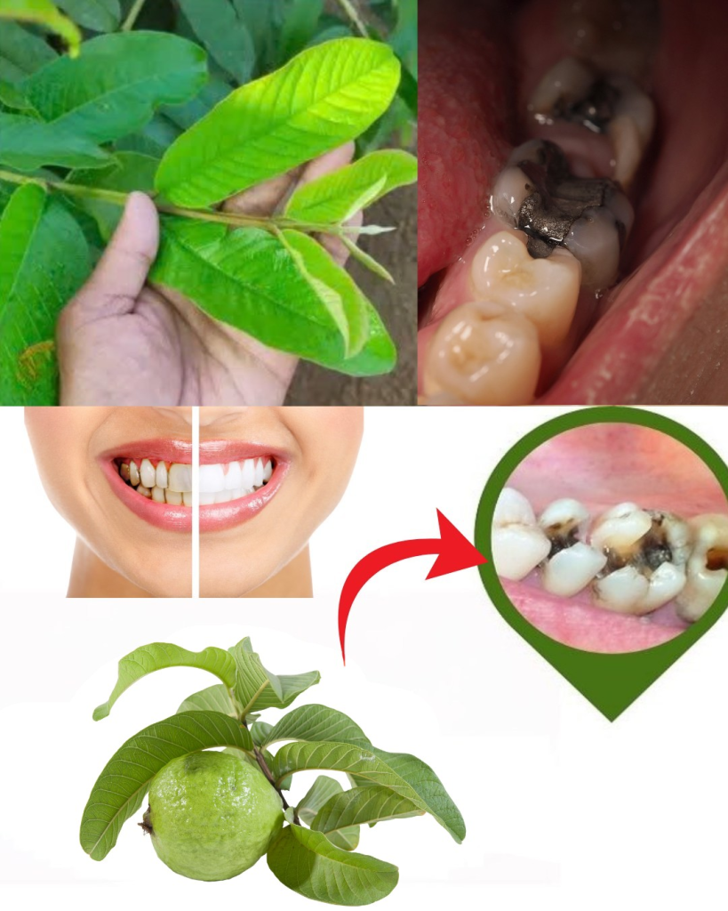 Descubre el Secreto de la Naturaleza: 3 Poderosos Remedios con Hojas de Guayaba para Combatir la Caries Dental