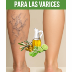 Remedio Natural para las Várices con Sábila, Vinagre y Limón Remedio Natural para las Várices con Sábila, Vinagre y Limón