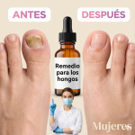 Remedio casero con clavos de olor y limón para los hongos: ¿funciona realmente?