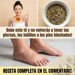 Té para Piernas Hinchadas: Remedio Natural para la Retención de Líquidos y la Mala Circulación