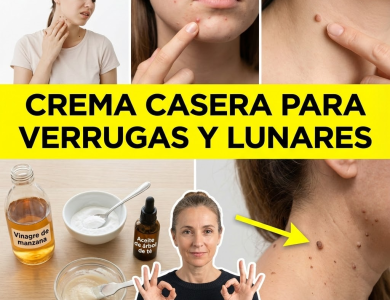 Crema Casera con Vinagre de Manzana, Bicarbonato y Árbol de Té para Verrugas y Lunares