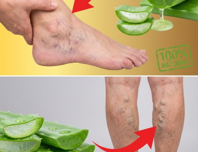 Aloe Vera para Piernas Hinchadas y Cansadas: El Remedio Natural que Tu Cuerpo Agradecerá