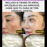 Crema Casera de Bicarbonato: Despídete de las Arrugas y Manchas en la Piel Crema Casera de Bicarbonato: Despídete de las Arrugas y Manchas en la Piel