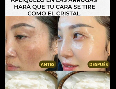 Crema Casera de Bicarbonato: Despídete de las Arrugas y Manchas en la Piel Crema Casera de Bicarbonato: Despídete de las Arrugas y Manchas en la Piel