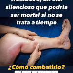 Las 6 Mejores Infusiones para Mantener Saludables tus Arterias Las 6 Mejores Infusiones para Mantener Saludables tus Arterias