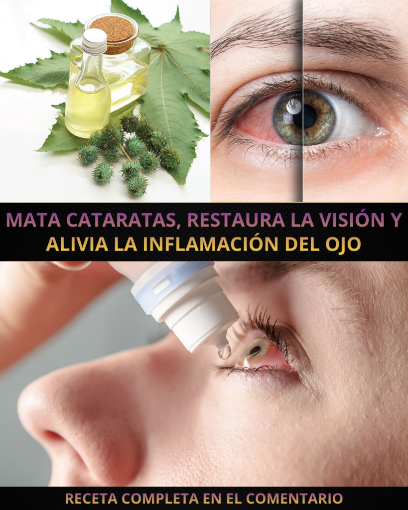 Remedio natural para cataratas e inflamación ocular: cómo apoyar tu visión de forma suave y casera Remedio natural para cataratas e inflamación ocular: cómo apoyar tu visión de forma suave y casera