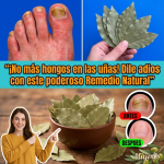 Laurel para Hongos en las Uñas: Cómo Usarlo de Forma Segura y Efectiva (Guía Completa)