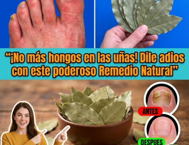Laurel para Hongos en las Uñas: Cómo Usarlo de Forma Segura y Efectiva (Guía Completa)