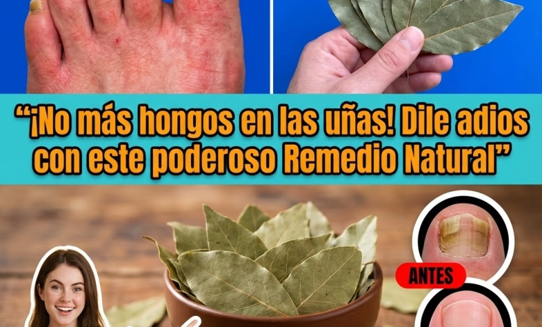 Laurel para Hongos en las Uñas: Cómo Usarlo de Forma Segura y Efectiva (Guía Completa)
