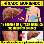 ¿Tu hígado está en peligro? 12 señales de cirrosis hepática que no debes ignorar
