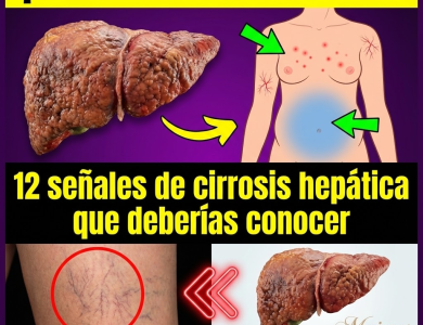 ¿Tu hígado está en peligro? 12 señales de cirrosis hepática que no debes ignorar ¿Tu hígado está en peligro? 12 señales de cirrosis hepática que no debes ignorar