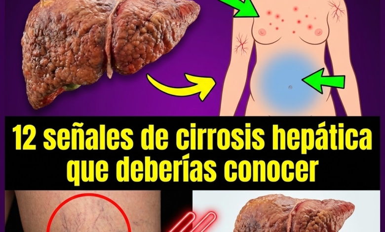 ¿Tu hígado está en peligro? 12 señales de cirrosis hepática que no debes ignorar
