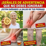 Limón y bienestar: 8 formas en que puede acompañar el alivio de piernas cansadas, rigidez articular y dolores de cabeza (sin exagerar)