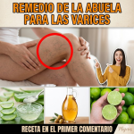 Remedio Casero con Sábila, Vinagre de Manzana y Limón para Várices: Cómo Prepararlo, Usarlo y Precauciones