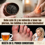 Té para Piernas Hinchadas: Receta Diurética y Antiinflamatoria, Cómo Tomarlo y Precauciones