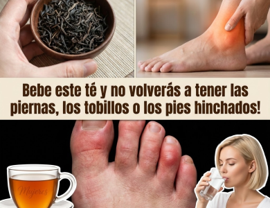 Té para Piernas Hinchadas: Receta Diurética y Antiinflamatoria, Cómo Tomarlo y Precauciones Té para Piernas Hinchadas: Receta Diurética y Antiinflamatoria, Cómo Tomarlo y Precauciones