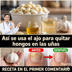 Ajo para hongos en cuero cabelludo, manos, uñas y pies: usos caseros, rutina práctica y precauciones (Guía clara)
