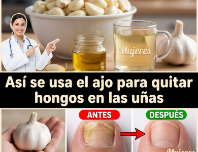 Ajo para hongos en cuero cabelludo, manos, uñas y pies: usos caseros, rutina práctica y precauciones (Guía clara)