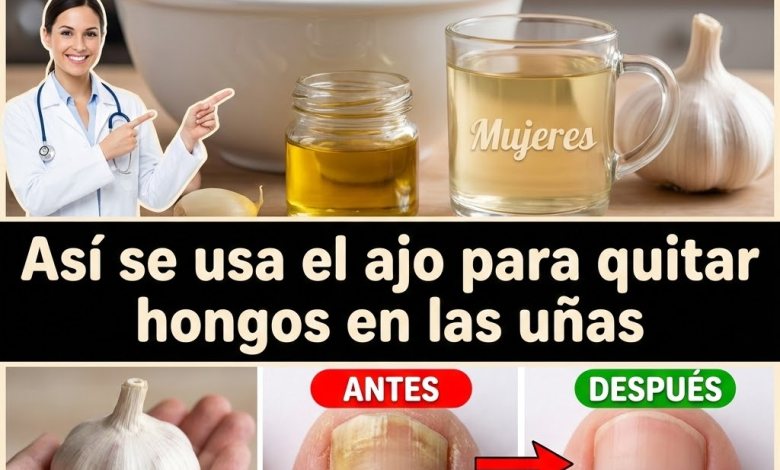 Ajo para hongos en cuero cabelludo, manos, uñas y pies: usos caseros, rutina práctica y precauciones (Guía clara)