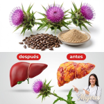 Cardo mariano: la “medicina gratuita” que protege tu hígado y tu salud