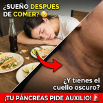 “¡No Manches!” – Tu Páncreas Rompe el Silencio: Por Qué Tienes Sueño Después de Comer y el Cuello Oscuro