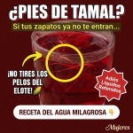 ¿Zapatos que Aprietan? El “Agua Milagrosa” de Jamaica y Pelos de Elote para Desinflar los Pies de Tamal
