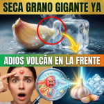 ¡Auxilio, Tengo un Volcán en la Frente! Seca ese Grano Gigante en UNA NOCHE con Ajo y Hielo (Remedio Express)