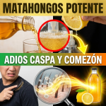 ¡¿Pareces Volcán Nevado?! Elimina la Caspa y la Comezón YA con este “Matahongos” de Vinagre y Limón ¡¿Pareces Volcán Nevado?! Elimina la Caspa y la Comezón YA con este “Matahongos” de Vinagre y Limón
