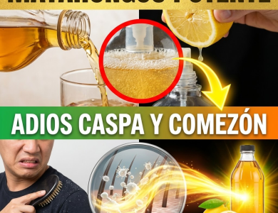 ¡¿Pareces Volcán Nevado?! Elimina la Caspa y la Comezón YA con este “Matahongos” de Vinagre y Limón ¡¿Pareces Volcán Nevado?! Elimina la Caspa y la Comezón YA con este “Matahongos” de Vinagre y Limón