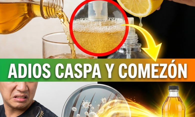 ¡¿Pareces Volcán Nevado?! Elimina la Caspa y la Comezón YA con este “Matahongos” de Vinagre y Limón