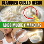 ¡¿Parece Mugre pero NO se Quita?! Blanquea tu Cuello Negro con Arroz y Leche (El Secreto de la “Piel de Porcelana”)
