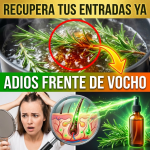 ¡¿Te Estás Quedando con “Frente de Vocho”?! Recupera el Cabello de tus Entradas con el Tónico de Romero (El Minoxidil Natural)