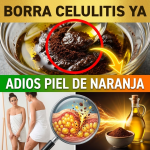 ¡¿Tus Piernas Parecen “Cáscara de Naranja”?! Borra la Celulitis y Logra una Piel de Durazno con Café