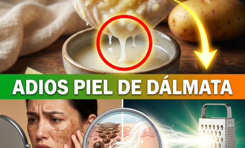 ¡¿Tienes “Piel de Dálmata” por el Sol?! Borra el Paño y las Manchas Oscuras con Jugo de Papa Cruda
