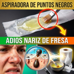 ¡¿Tienes la Nariz como “Fresa”?! Arranca los Puntos Negros de Raíz con la “Aspiradora” de Clara de Huevo ¡¿Tienes la Nariz como “Fresa”?! Arranca los Puntos Negros de Raíz con la “Aspiradora” de Clara de Huevo