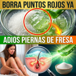 ¡¿Tus Piernas Parecen “Fresa”?! Borra los Puntitos Rojos y Vellos Enterrados con Sábila y Azúcar