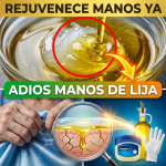 ¡¿Tienes “Manos de Lija”?! Rejuvenece tu Piel 20 Años en una Sola Noche con Vaselina y Dólar de Oliva